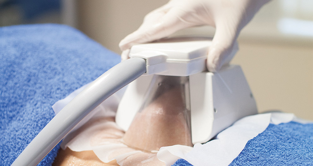 How Fat Freezing and HIFU Work Together? 2 Multiple Areas in One Session HIFU and Fat Freezing Beccles