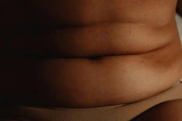 The Hidden Connection: How Stress Shapes Your Fitness and Body Composition 3 image of what stress can do on the stomach area and how Lipo 360 Beccles can help to change your body shape.
